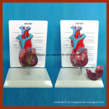 Tamanho físico Modelo de anatomia cardíaca com tubo de sangue longo humano com placa de descrição